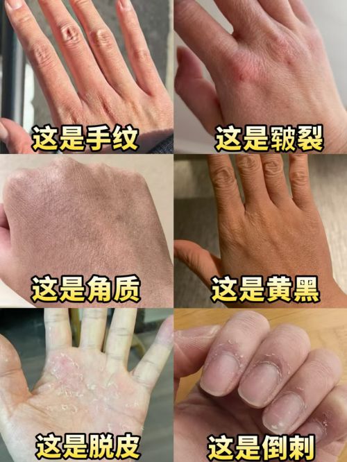 排行榜推荐排行榜十款公认好用的护手霜凯发K8国际娱乐2025年）护手霜(图2)